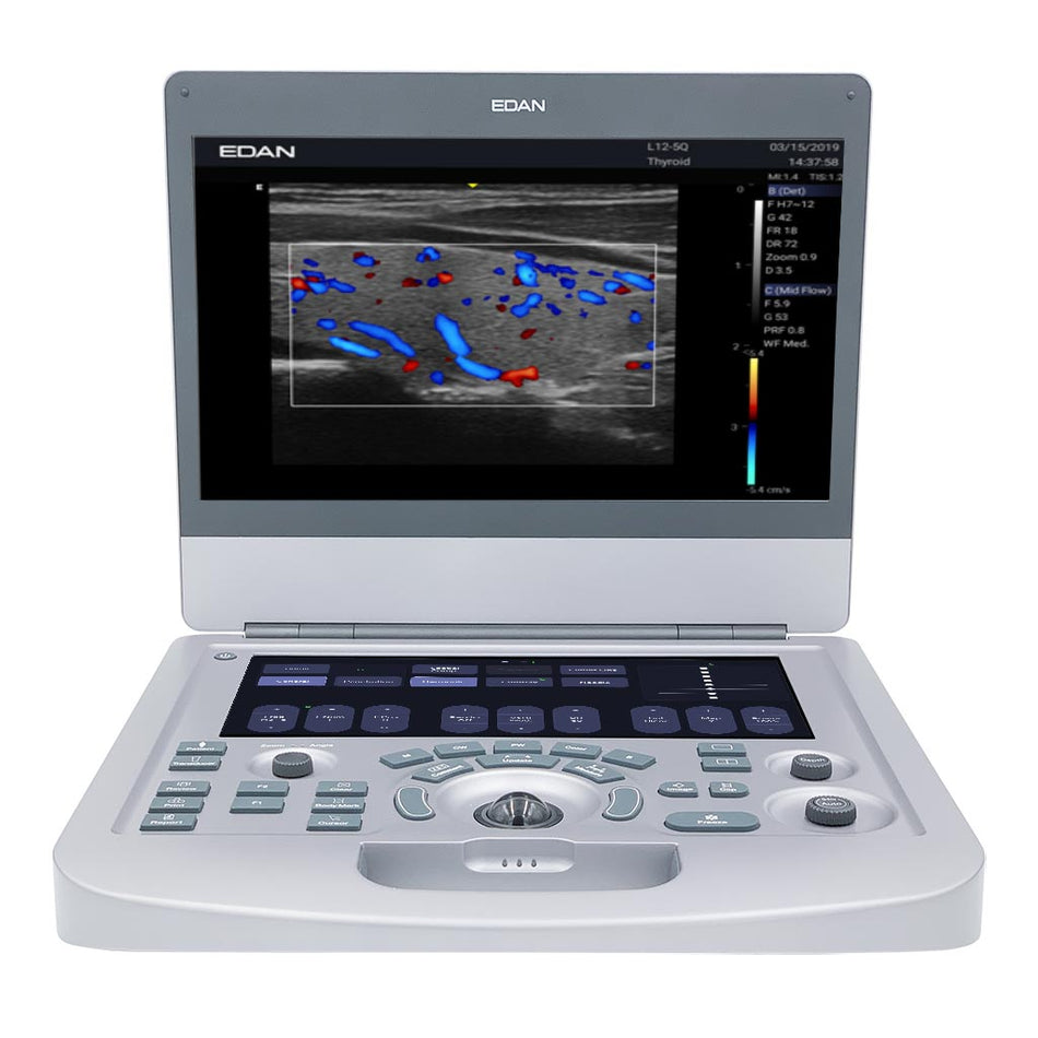 Edan  Acclarix AX2 / AX3 Diagnostic Ultrasound System