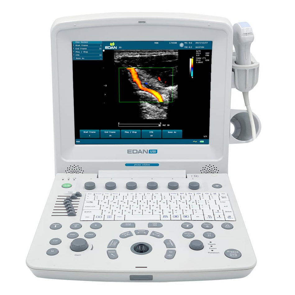 Edan U50 Prime Ultrasound System